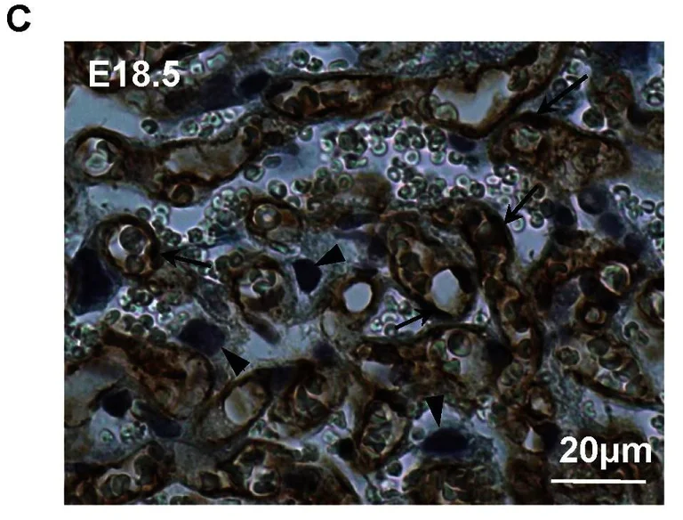 Immunohistochemistry (Formalin/PFA-fixed paraffin-embedded sections) - Anti-CD31 antibody [RM0032-1D12] - BSA and Azide free (AB56299)