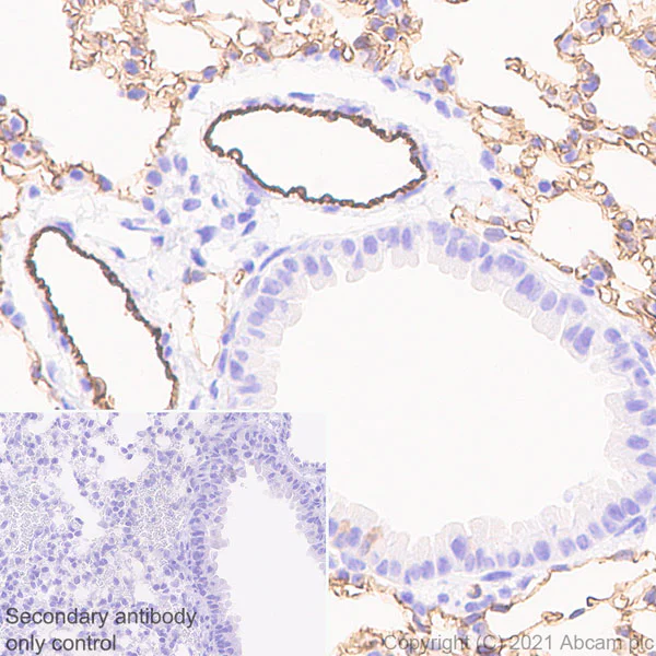 Immunohistochemistry (Formalin/PFA-fixed paraffin-embedded sections) - Anti-CD31 antibody [RM1006] (AB281583)