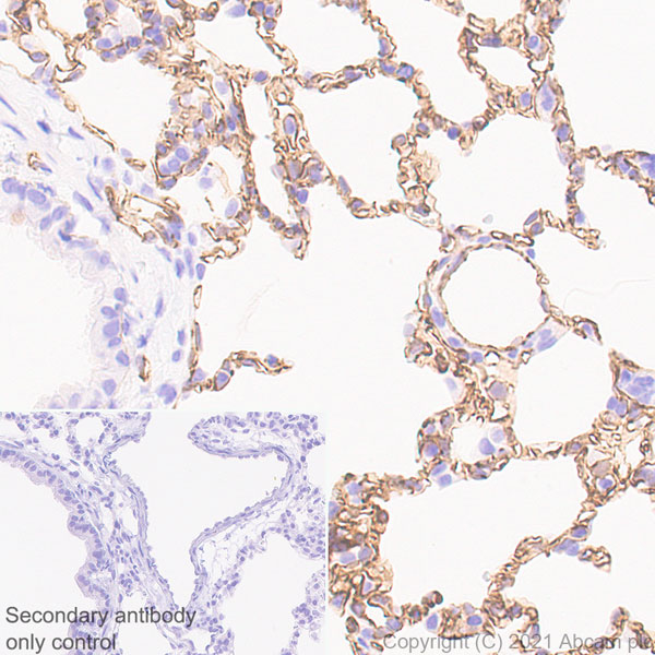 Immunohistochemistry (Formalin/PFA-fixed paraffin-embedded sections) - Anti-CD31 antibody [RM1006] (AB281583), expandable thumbnail