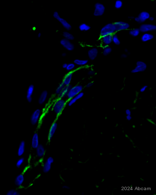 Immunohistochemistry (Formalin/PFA-fixed paraffin-embedded sections) - Anti-CD31 antibody [RM1006] (ab281583), expandable thumbnail