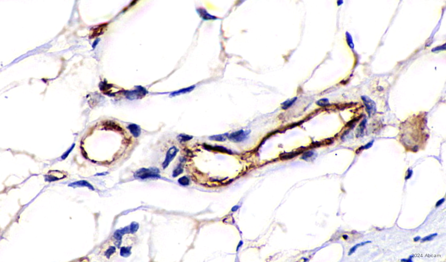 Immunohistochemistry (Formalin/PFA-fixed paraffin-embedded sections) - Anti-CD31 antibody [RM1006] (ab281583), expandable thumbnail