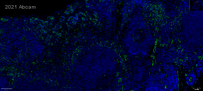 Immunohistochemistry (Formalin/PFA-fixed paraffin-embedded sections) - Anti-CD31 antibody [RM1006] (ab281583), expandable thumbnail