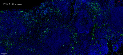 Immunohistochemistry (Formalin/PFA-fixed paraffin-embedded sections) - Anti-CD31 antibody [RM1006] (AB281583)