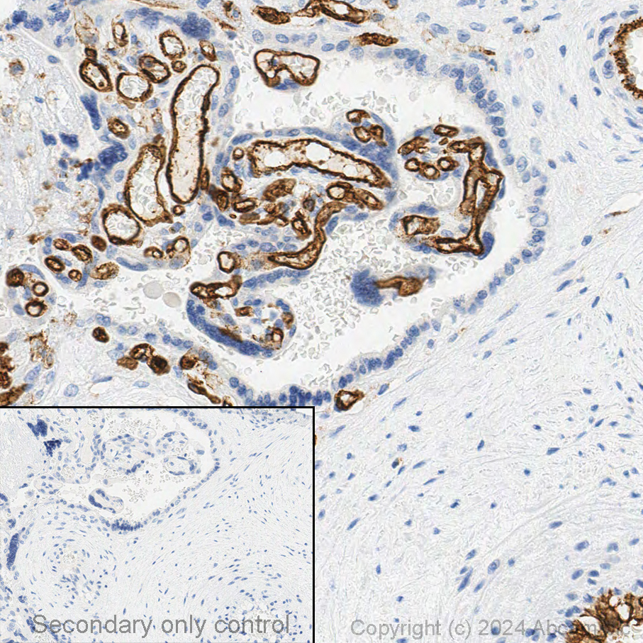 Immunohistochemistry (Formalin/PFA-fixed paraffin-embedded sections) - Anti-CD31 antibody [RM1006] (ab281583), expandable thumbnail