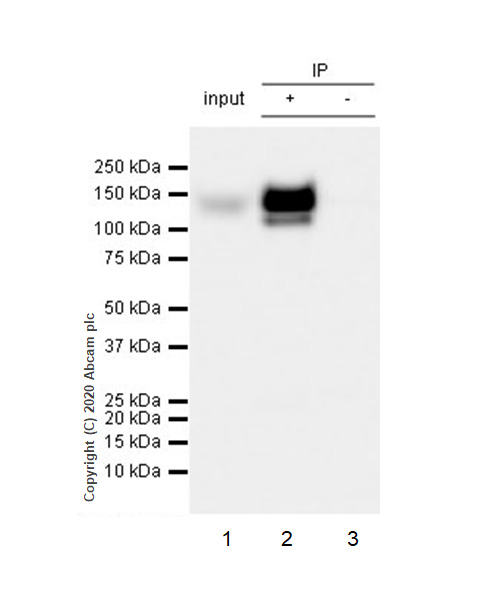 Immunoprecipitation - Anti-CD31 antibody [RM1006] (AB281583), expandable thumbnail