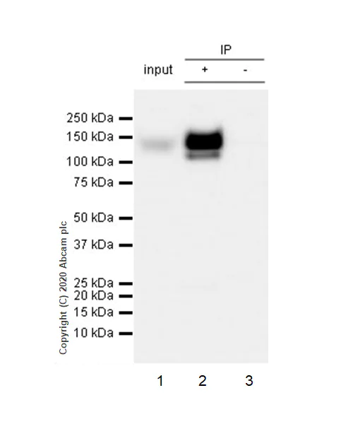Immunoprecipitation - Anti-CD31 antibody [RM1006] (AB281583)