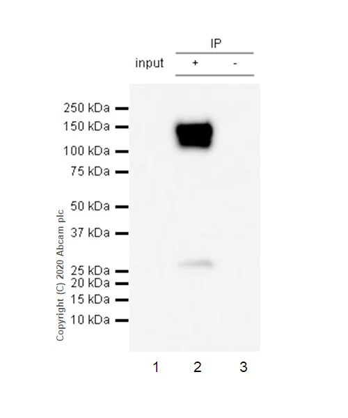 Immunoprecipitation - Anti-CD31 antibody [RM1006] (AB281583)