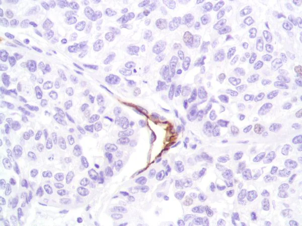 Immunohistochemistry (Formalin/PFA-fixed paraffin-embedded sections) - Anti-CD31 antibody [SP164] - BSA and Azide free (AB243932)