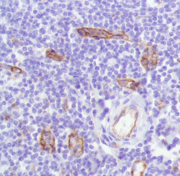Immunohistochemistry (Formalin/PFA-fixed paraffin-embedded sections) - Anti-CD31 antibody [SP164] - BSA and Azide free (AB243932), expandable thumbnail