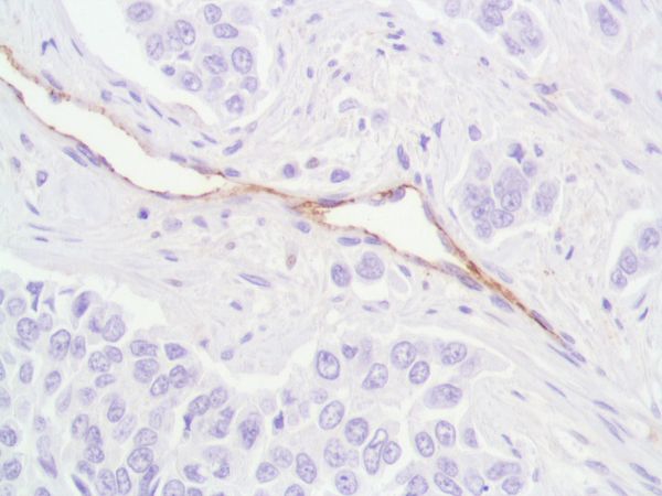 Immunohistochemistry (Formalin/PFA-fixed paraffin-embedded sections) - Anti-CD31 antibody [SP164] - BSA and Azide free (ab243932), expandable thumbnail