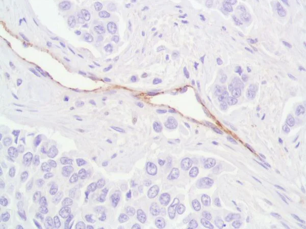 Immunohistochemistry (Formalin/PFA-fixed paraffin-embedded sections) - Anti-CD31 antibody [SP164] - BSA and Azide free (AB243932)