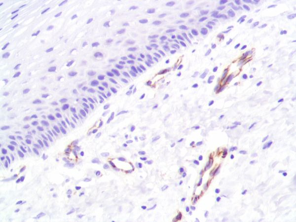 Immunohistochemistry (Formalin/PFA-fixed paraffin-embedded sections) - Anti-CD31 antibody [SP164] - BSA and Azide free (AB243932), expandable thumbnail