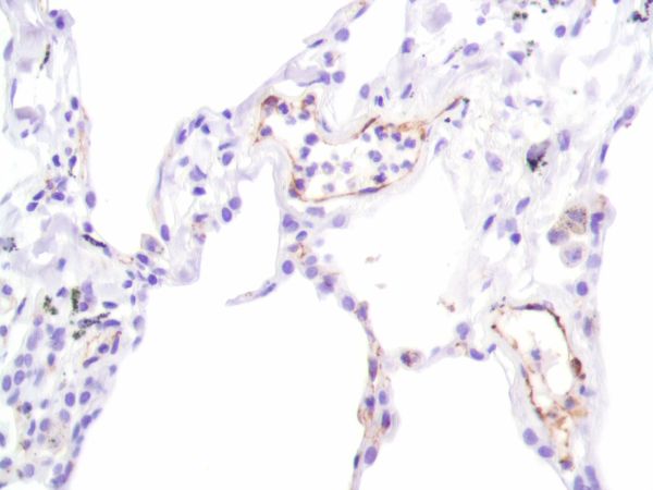 Immunohistochemistry (Formalin/PFA-fixed paraffin-embedded sections) - Anti-CD31 antibody [SP164] - BSA and Azide free (ab243932), expandable thumbnail