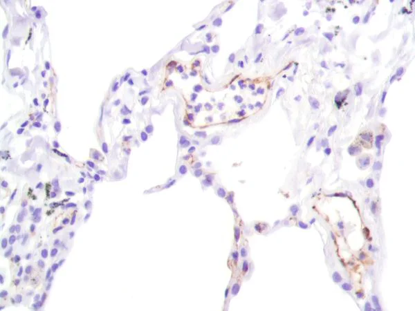 Immunohistochemistry (Formalin/PFA-fixed paraffin-embedded sections) - Anti-CD31 antibody [SP164] - BSA and Azide free (AB243932)