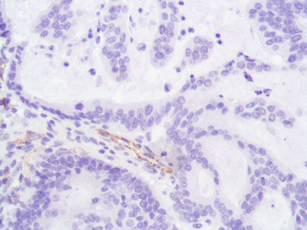Immunohistochemistry (Formalin/PFA-fixed paraffin-embedded sections) - Anti-CD31 antibody [SP164] - BSA and Azide free (ab243932), expandable thumbnail