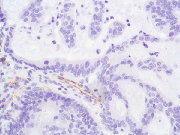 Immunohistochemistry (Formalin/PFA-fixed paraffin-embedded sections) - Anti-CD31 antibody [SP164] - BSA and Azide free (AB243932)