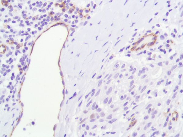 Immunohistochemistry (Formalin/PFA-fixed paraffin-embedded sections) - Anti-CD31 antibody [SP164] - BSA and Azide free (AB243932), expandable thumbnail