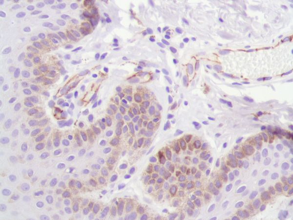 Immunohistochemistry (Formalin/PFA-fixed paraffin-embedded sections) - Anti-CD31 antibody [SP164] - BSA and Azide free (ab243932), expandable thumbnail