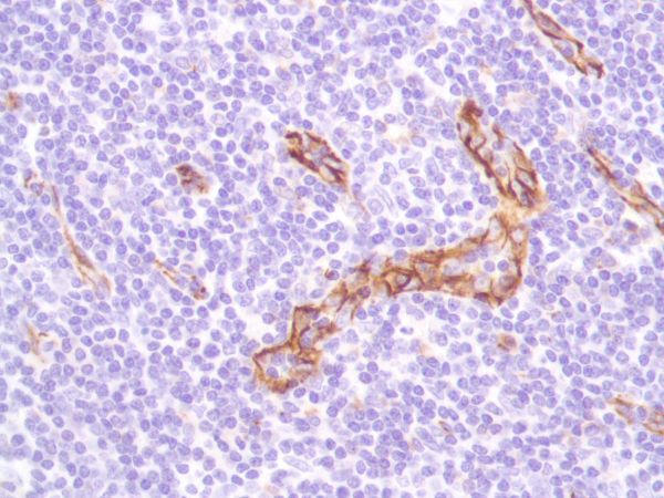 Immunohistochemistry (Formalin/PFA-fixed paraffin-embedded sections) - Anti-CD31 antibody [SP164] - BSA and Azide free (ab243932), expandable thumbnail