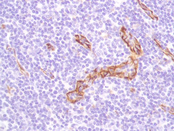 Immunohistochemistry (Formalin/PFA-fixed paraffin-embedded sections) - Anti-CD31 antibody [SP164] - BSA and Azide free (AB243932)