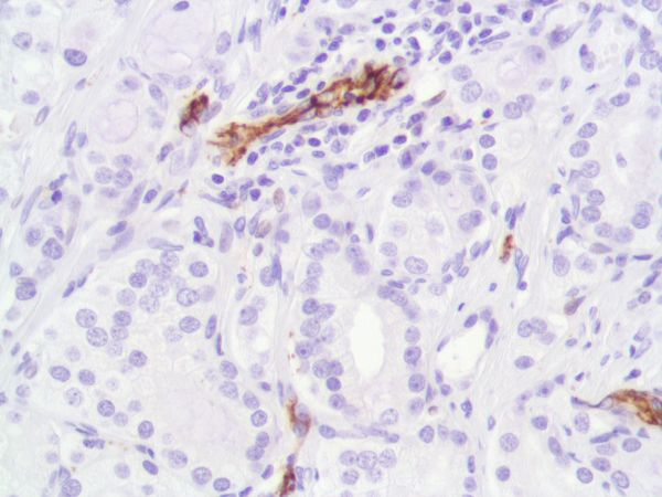 Immunohistochemistry (Formalin/PFA-fixed paraffin-embedded sections) - Anti-CD31 antibody [SP164] - BSA and Azide free (ab243932), expandable thumbnail