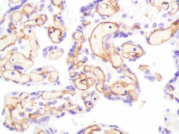 Immunohistochemistry (Formalin/PFA-fixed paraffin-embedded sections) - Anti-CD31 antibody [SP164] - BSA and Azide free (ab243932), expandable thumbnail