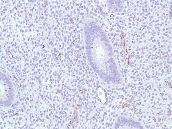 Immunohistochemistry (Formalin/PFA-fixed paraffin-embedded sections) - Anti-CD31 antibody [SP38] (AB231436)