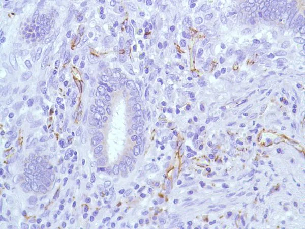 Immunohistochemistry (Formalin/PFA-fixed paraffin-embedded sections) - Anti-CD31 antibody [SP38] (AB231436)