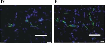 Immunohistochemistry - Anti-CD31 antibody [TLD-3A12] (AB64543)