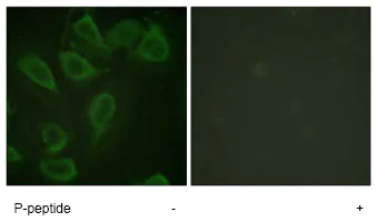 Immunocytochemistry - Anti-CD31 (phospho Y713) antibody (AB62169)