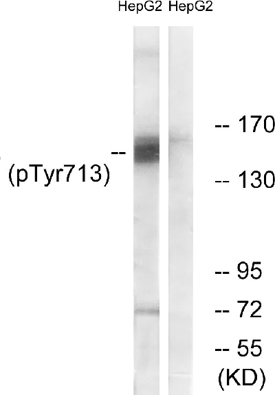 Western blot - Anti-CD31 (phospho Y713) antibody (AB62169)