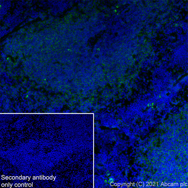 Immunohistochemistry (Frozen sections) - Anti-CD32 antibody [AT130-2] (AB282740), expandable thumbnail