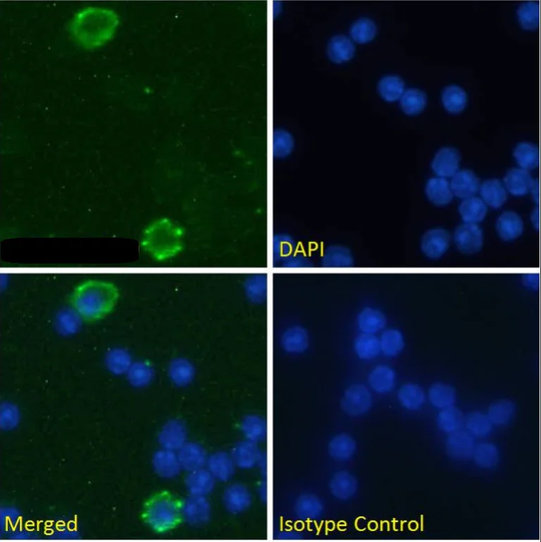 Immunocytochemistry - Anti-CD32 antibody [AT130-5] - Rabbit IgG (Chimeric) (AB281897)