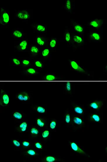 Immunocytochemistry/ Immunofluorescence - Anti-CD32A antibody (AB196829)