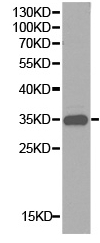 Western blot - Anti-CD32A antibody (AB196829)