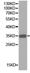 Western blot - Anti-CD32A antibody (AB196829)