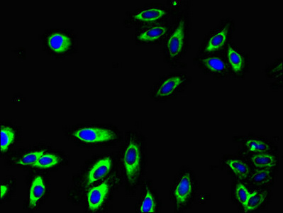 Immunocytochemistry/ Immunofluorescence - Anti-CD32A antibody (AB223039), expandable thumbnail