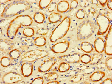 Immunohistochemistry (Formalin/PFA-fixed paraffin-embedded sections) - Anti-CD32A antibody (AB223039), expandable thumbnail