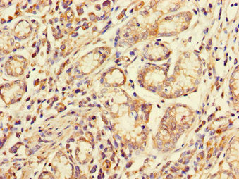 Immunohistochemistry (Formalin/PFA-fixed paraffin-embedded sections) - Anti-CD32A antibody (AB223039), expandable thumbnail