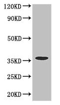 Western blot - Anti-CD32A antibody (AB223039), expandable thumbnail