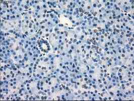 Immunohistochemistry (Formalin/PFA-fixed paraffin-embedded sections) - Anti-CD32A antibody [OTI9C6] (AB124408)
