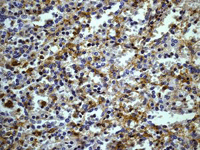 Immunohistochemistry (Formalin/PFA-fixed paraffin-embedded sections) - Anti-CD32A + CD32C antibody [EPR6658] (AB125013)