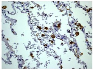 Immunohistochemistry (Formalin/PFA-fixed paraffin-embedded sections) - Anti-CD32A + CD32C antibody [EPR6658] (AB125013)