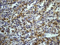Immunohistochemistry (Formalin/PFA-fixed paraffin-embedded sections) - Anti-CD32A + CD32C antibody [EPR6658] - BSA and Azide free (AB248099)
