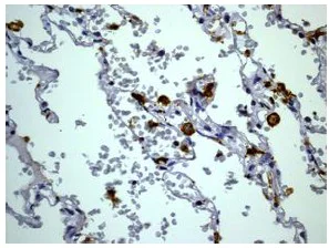 Immunohistochemistry (Formalin/PFA-fixed paraffin-embedded sections) - Anti-CD32A + CD32C antibody [EPR6658] - BSA and Azide free (AB248099)