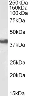Western blot - Anti-CD32B antibody (AB77093)