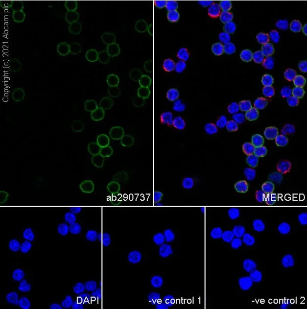 Immunocytochemistry/ Immunofluorescence - Anti-CD32B antibody [AT130-5] (BSA and Azide free) (AB290752)
