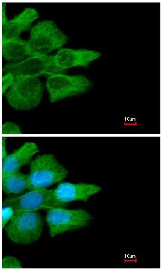 Immunocytochemistry/ Immunofluorescence - Anti-CD32B antibody - C-terminal (AB151497)