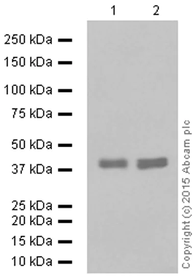 Western blot - Anti-CD32B antibody [EP888Y] (AB45143)