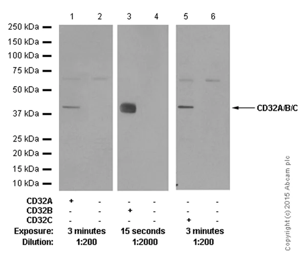 Western blot - Anti-CD32B antibody [EP888Y] (AB45143)